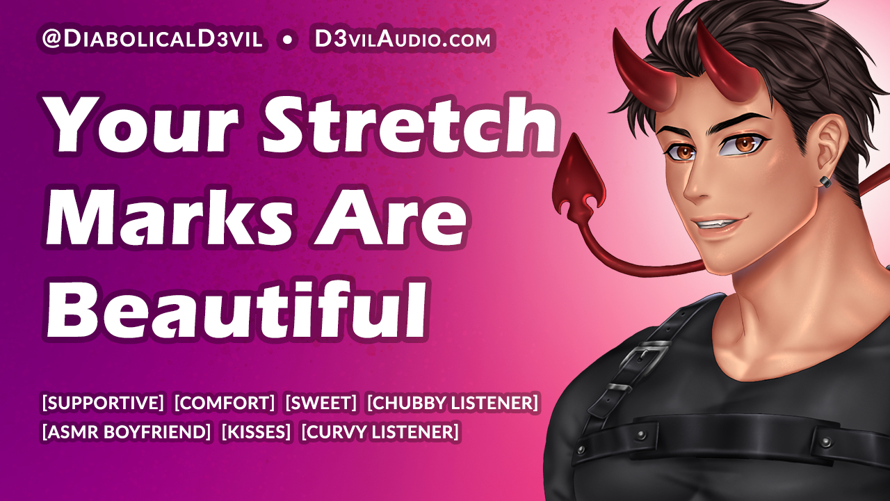Stretch Marks Are Beautiful